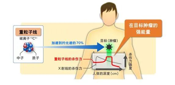 哪些保险可以保普通人“高攀不起”质子重离子治疗？插图10