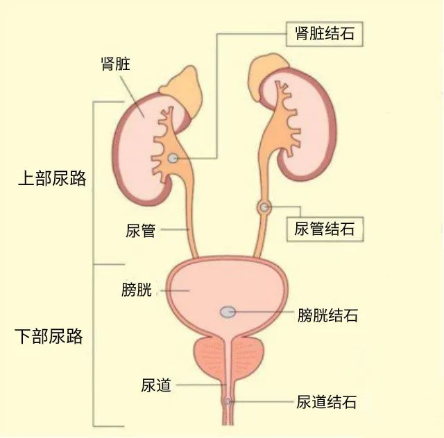 有结石类的泌尿系统疾病可以买保险吗？有什么保险可以买呢？插图