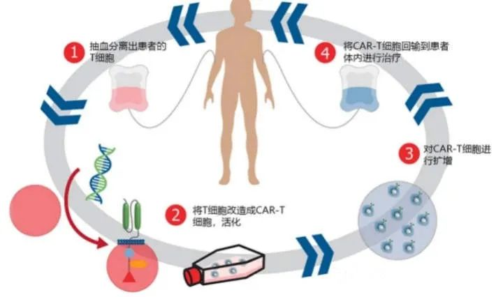 一针就能消除癌症？CAR-T治疗到底有多厉害？插图2